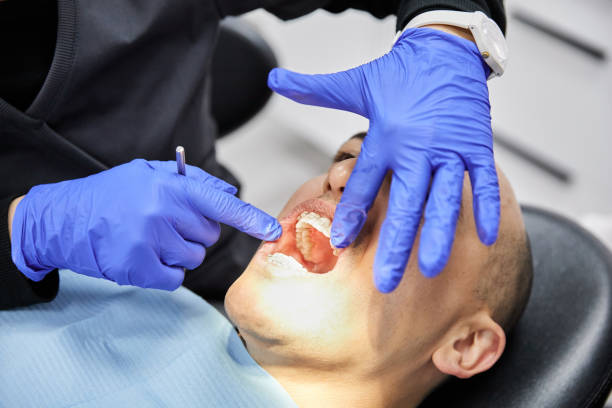 Best Emergency Tooth Extraction in Edgemont Park, MI